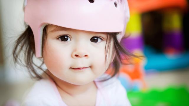 A toddler wearing pink orthopedic helmet.
