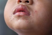 Child's face with hand, foot. and mouth