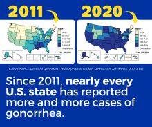 More cases of gonorrhea