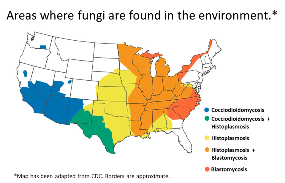 Coccidioidomycosis Map